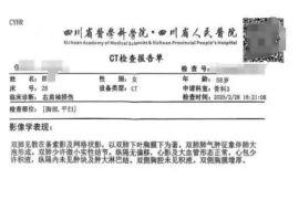患者在医院接受CT检查时，其图像被弄混，导致女子误诊断“绝症”。导致该女子按照医嘱服用了药物长达三个月。-小胖资源分享网