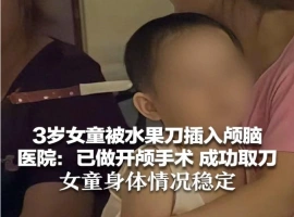 三岁女童头部被水果刀刺伤，紧急开颅取出刀具，目前无生命危险，状况稳定。-小胖资源分享网