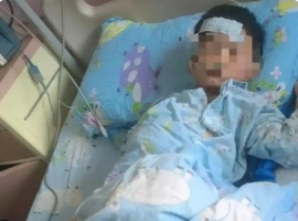 一名六岁的孩童不幸赤脚踏上一条已故的鱼，事故后果严重，紧急被送往重症监护室（ICU）接受治疗。-小胖资源分享网